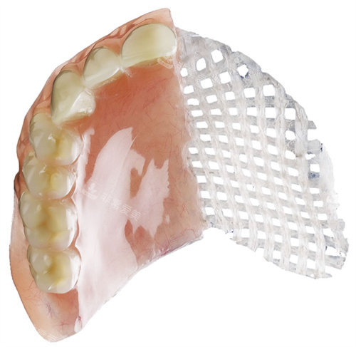 吸附性义齿和内部结构