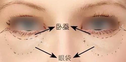 眼周组织图 眼周组织图