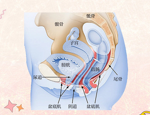 盆底肌修复漫画示意图