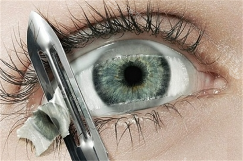 眼角膜割除眼睛局部图
