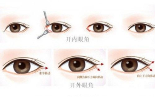 开内眼角卡通图