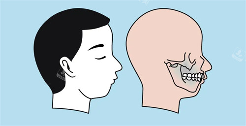 凸嘴的图片 凸嘴的图片