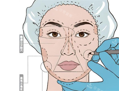 面部輪廓整形卡通設(shè)計圖片