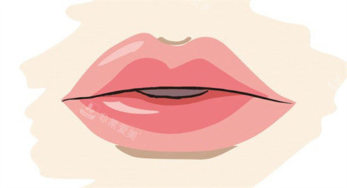 丰唇 丰唇