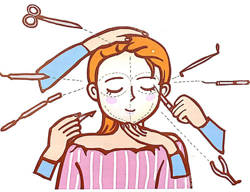 面部轮廓整形卡通图展示 面部轮廓整形卡通图展示