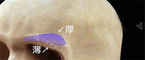 眉弓骨骼示意图展示