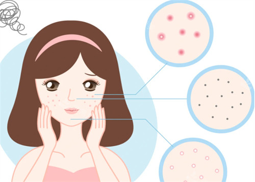 韩国圣水世林皮肤科医院怎么样？核心技术优势/诊疗流程/口碑评价，避坑指南看这篇就够！