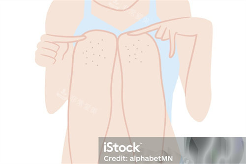 脱毛项目展示图 脱毛项目展示图