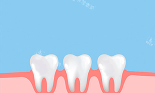 牙齿动画展示图