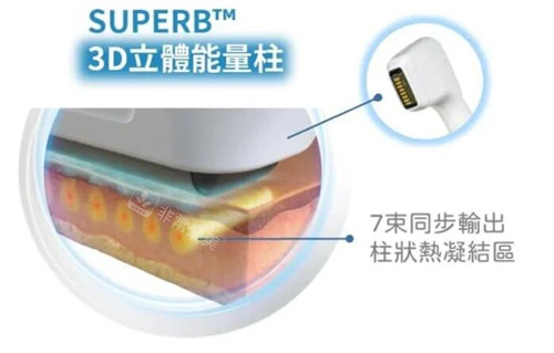 索夫波sofwave儀器能量柱 索夫波sofwave儀器能量柱