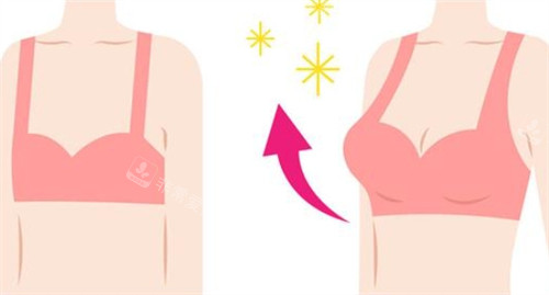 河南刘清亮做的隆胸怎么样？技术、手感、改善、顾客真实体验！