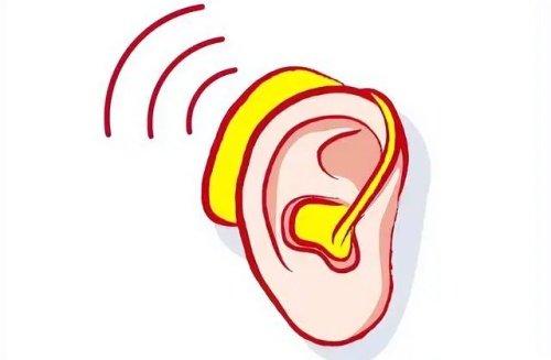 人工耳蜗漫画示意图