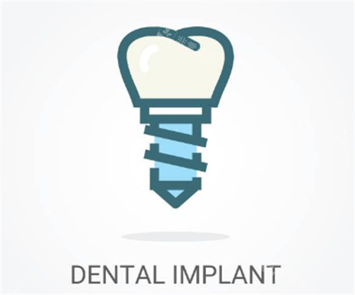种植牙线条示意图