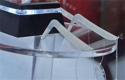 超体隆鼻展示照片