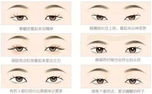 不同可以进行双眼皮的眼睛