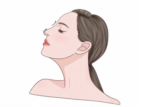 隆鼻卡通动画图片