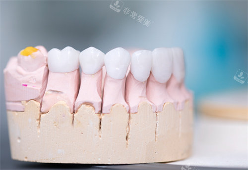 牙齿模型图展示图片