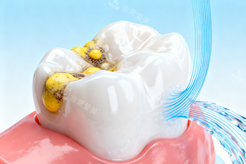 牙齿清洁卡通图