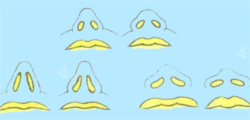 各种不同的鼻子