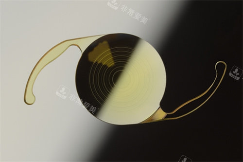 三焦点人工晶体价格