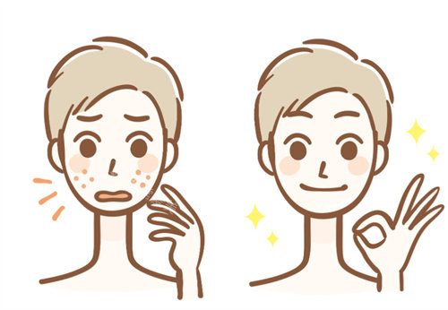 祛斑前后卡通对比图