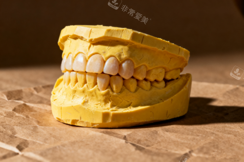 牙齿模型图一览