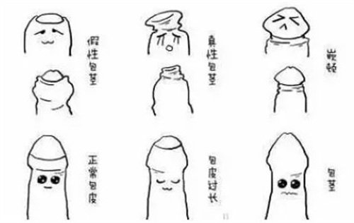 包皮的类型
