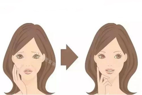 面部注射卡通对比图 面部注射卡通对比图