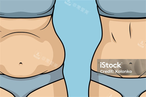 产后吸脂展示图