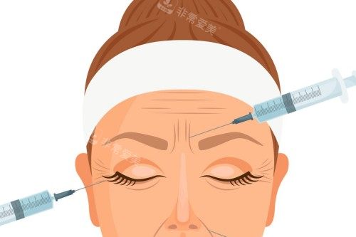 面部注射卡通展示图