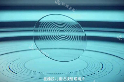 星趣控儿童近视管理镜片