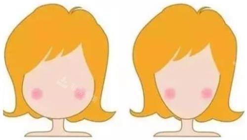 打针瘦脸明显对比图