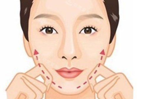 颊脂垫祛除术后卡通图