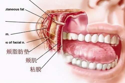 颊脂垫图片一览