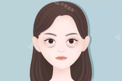 眼袋卡通图展示