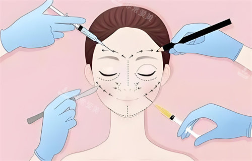 面部注射图展示