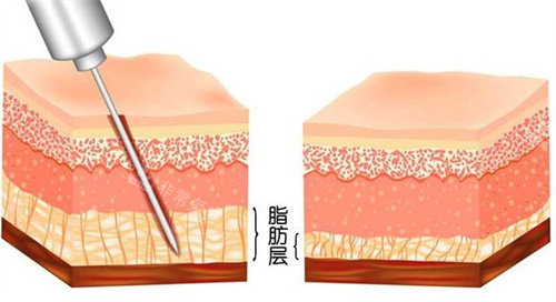 韩国济州岛nalssin医...