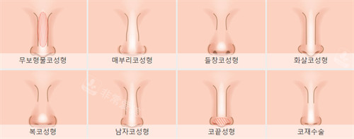 李长富医生隆鼻价格表...