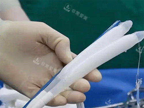 男性三件套假体照片