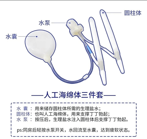 人工海绵体三件套