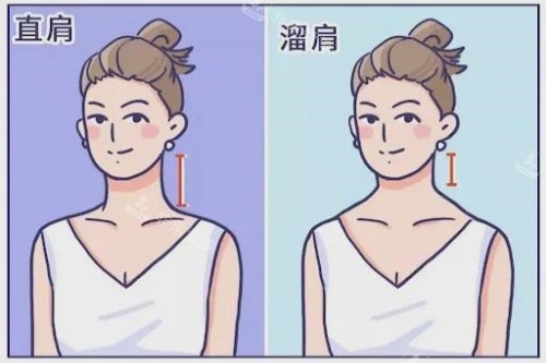 溜肩直角肩卡通图