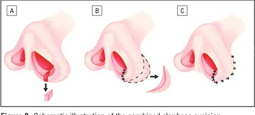南京做医美整形各项目收费价格表！整理眼鼻整形吸脂手术面部填充打玻尿酸各项目价格明细！
