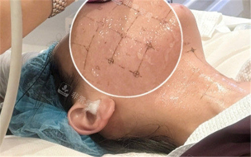 熱瑪吉點(diǎn)位設(shè)計(jì)