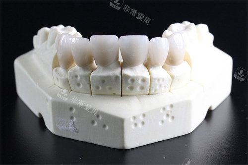 牙齿模型展示图