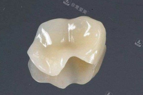 补牙材料卡通图