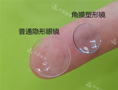 普通眼镜和角膜塑形镜对比照片
