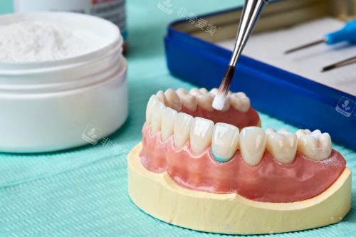 口腔涂氟卡通展示图