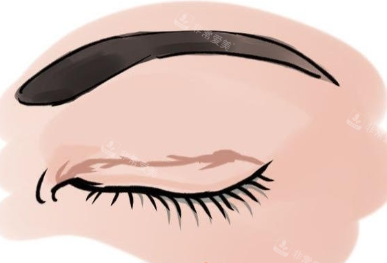 眼角增生疤痕动画展示图