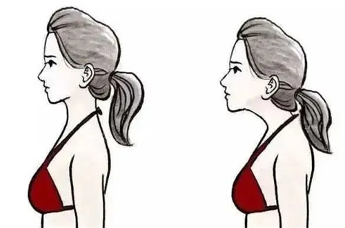 富贵包前后对比图片