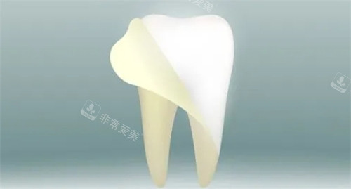 牙齿美白改善牙黄问题